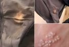 BE CAREFUL , If you spot these dots on your skin, it means you have Can…Read more